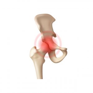 Cartilage & Tissue